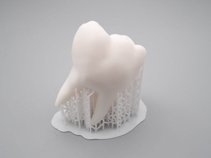光造形3Dプリンターで作成した歯
